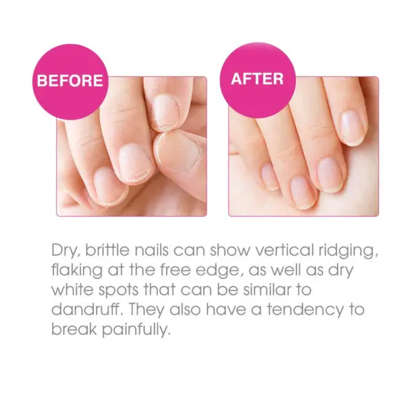 Nail Tek Protection Plus 3 Strengthener for Hard and Brittle Nails before after